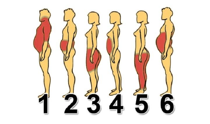 6 types de prise de poids