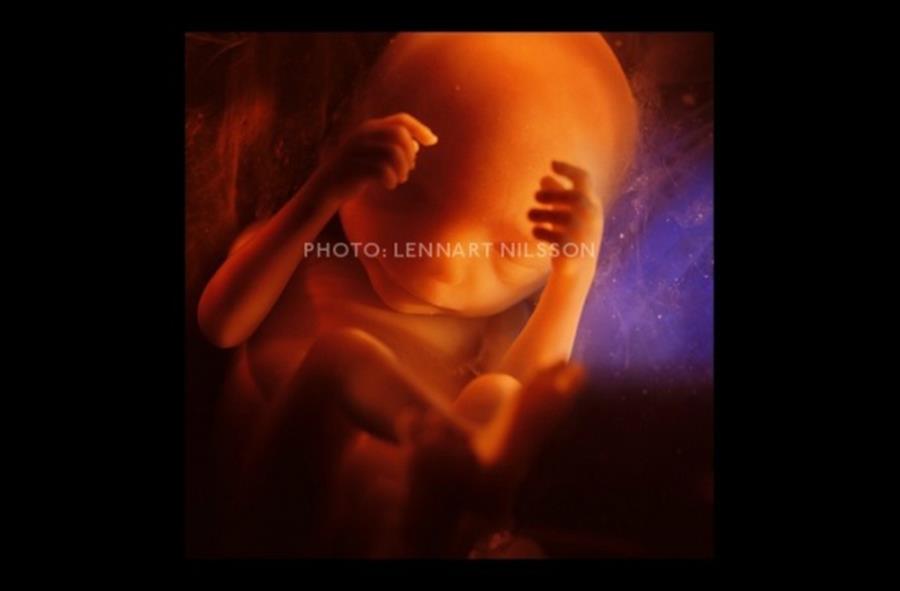 Foetus à six mois