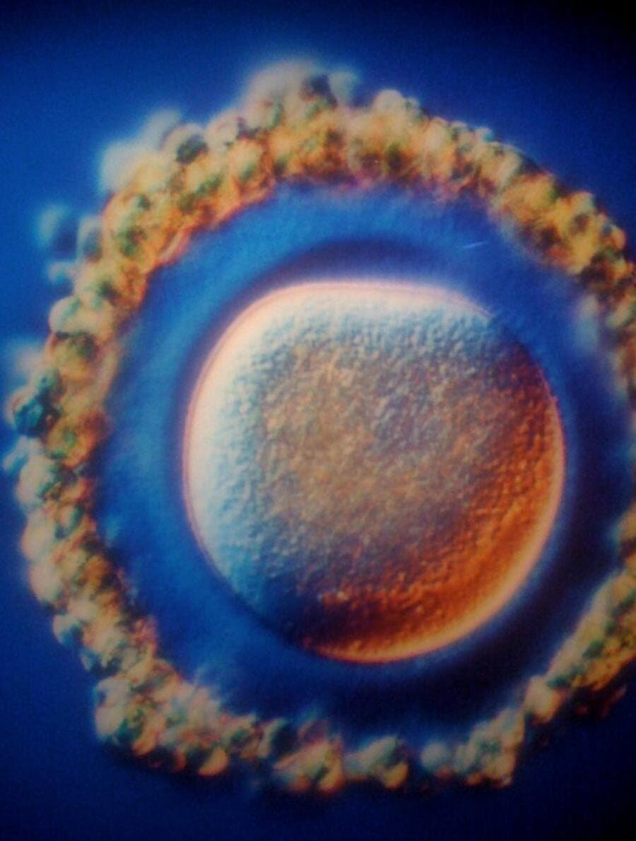 photo d'un ovule