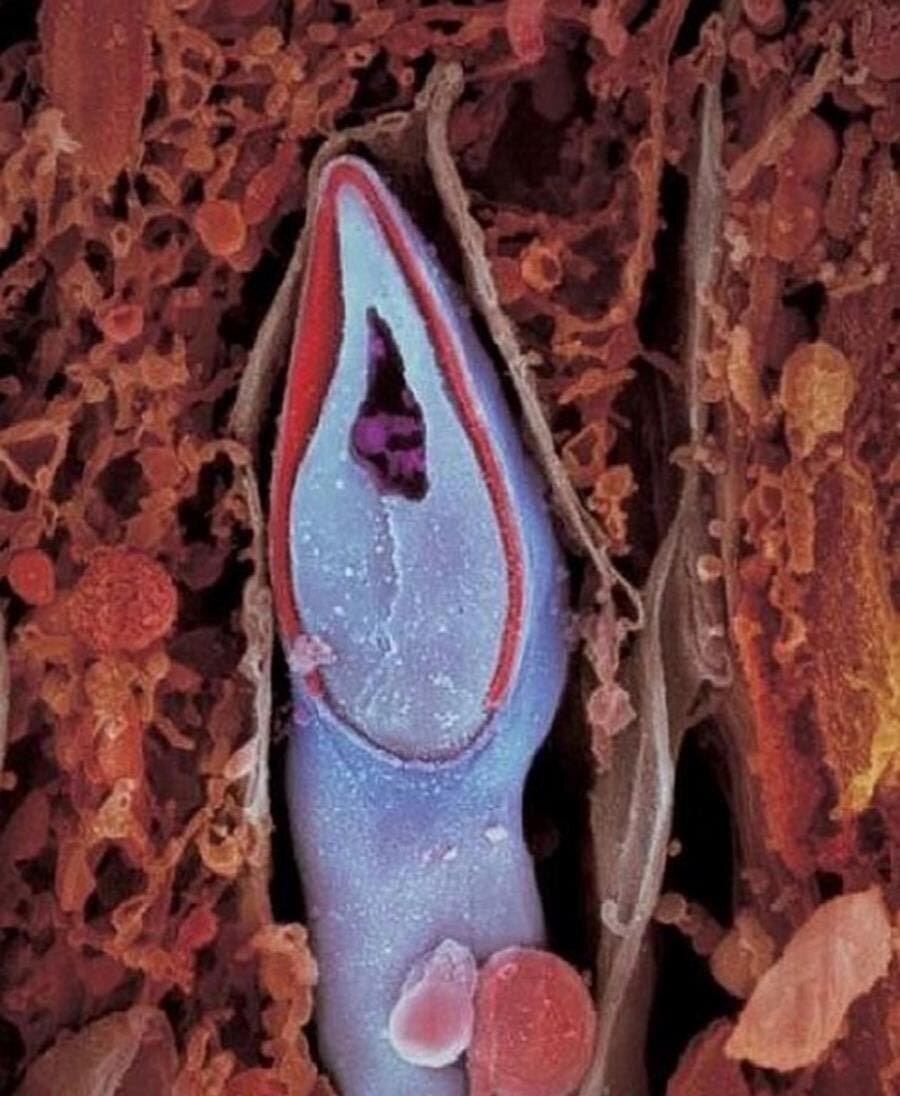 Photographie de la tête d'un spermatozoïde