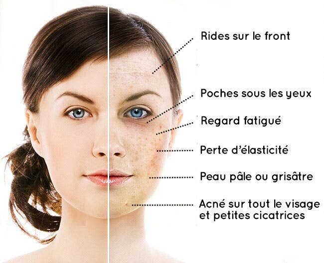 photo,resultats,méfaits,peau,aliments,sucre