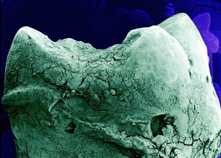 dent, microscope