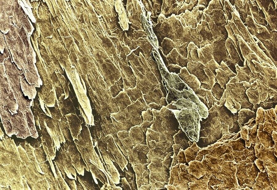 ongle, microscope