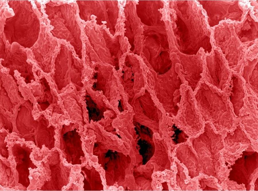 poumons, microscope