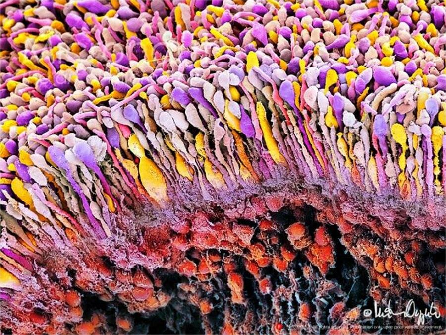 rétine, microscope