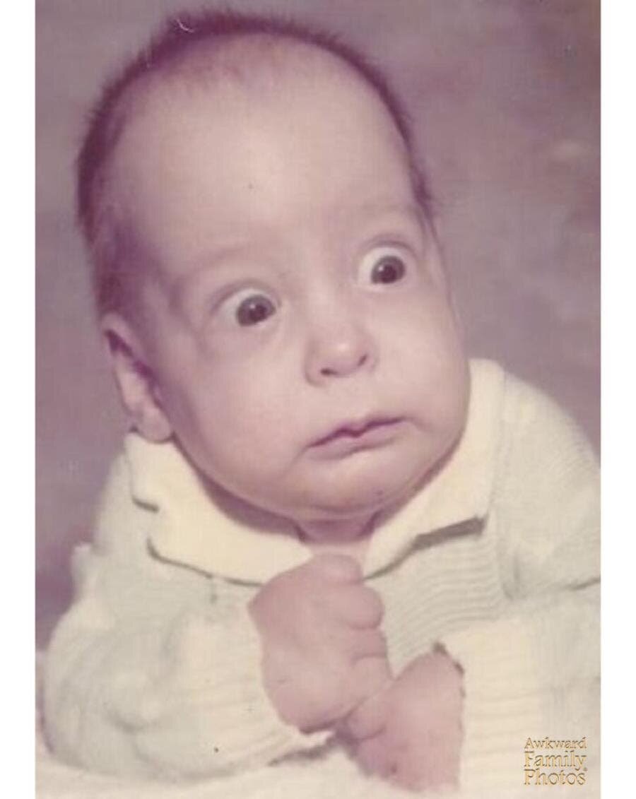 bébé choqué yeux 