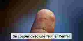 7 petits bobos du quotidien qui font pourtant hyper mal
