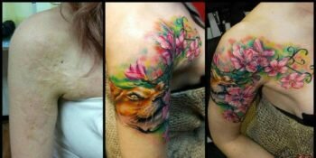 Couv Tattoos Cicatrices