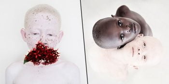 Photos Albinos