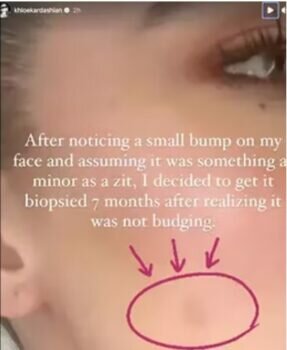 Khloe Kardashian Tres Malade On Vous Dit Tout Sur Sa Fortune Colossale