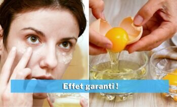 Top 5 Des Masques Au Blanc D’œuf Pour Le Visage